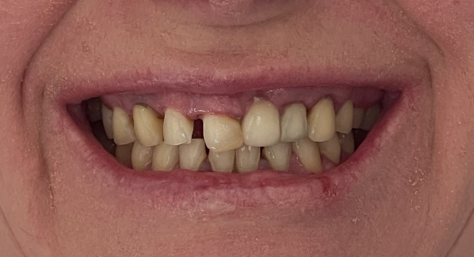 Before treatment