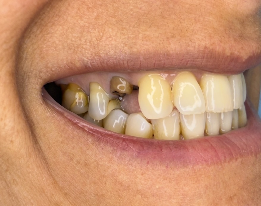 Before treatment